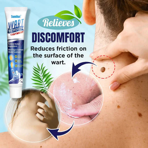 Wart Remover™- Tratamiento para combatir lunares y verrugas en la piel