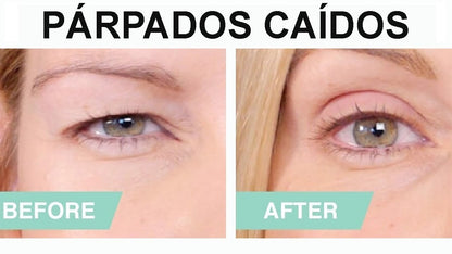 EYEDUP I CINTA INVISIBLE LEVANTA PÁRPADOS™